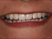 Konig Center for Cosmetic & Comprehensive Dentistry smile photos